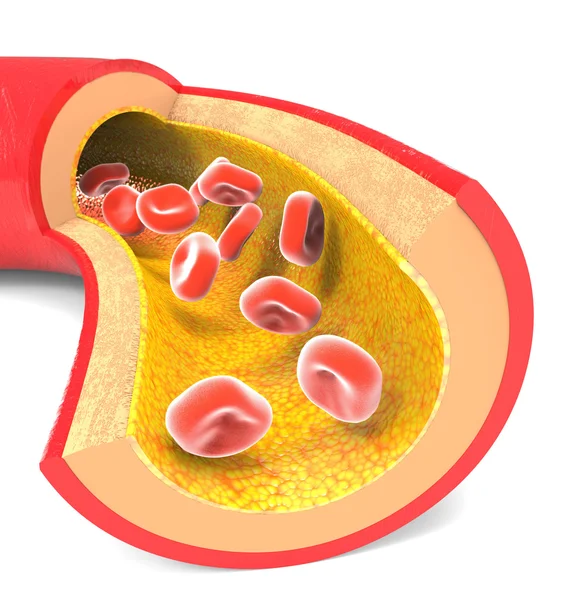 Arteria normale con globuli rossi — Foto Stock