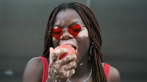 Close Shot African American Woman Vitiligo Sunglasses Looking Camera Smiling — Αρχείο Βίντεο