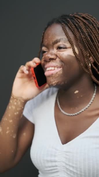 Close Shot African American Woman Vitiligo Smiling While Talking Phone — Stockvideo