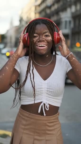 Young African American Woman Vitiligo Looking Camera Smiling While Listening — Wideo stockowe