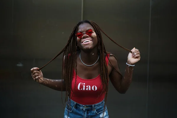 Веселая Афроамериканка Витилиго Солнцезащитных Очках Смеется Держа Косички Волос — стоковое фото