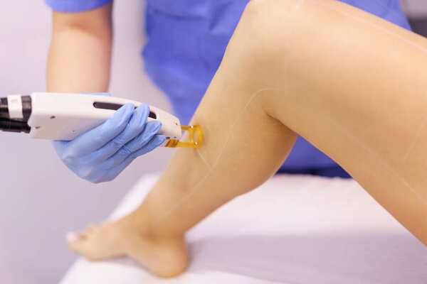 Woman receiving legs laser hair removal at a beauty center.
