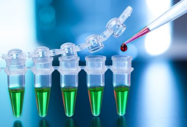 pcr örnek numaralı plastik tüpler yükleme