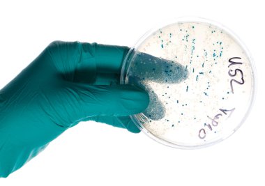 nitril eldiven elinde tutan petri dish ile bakteri kolonileri