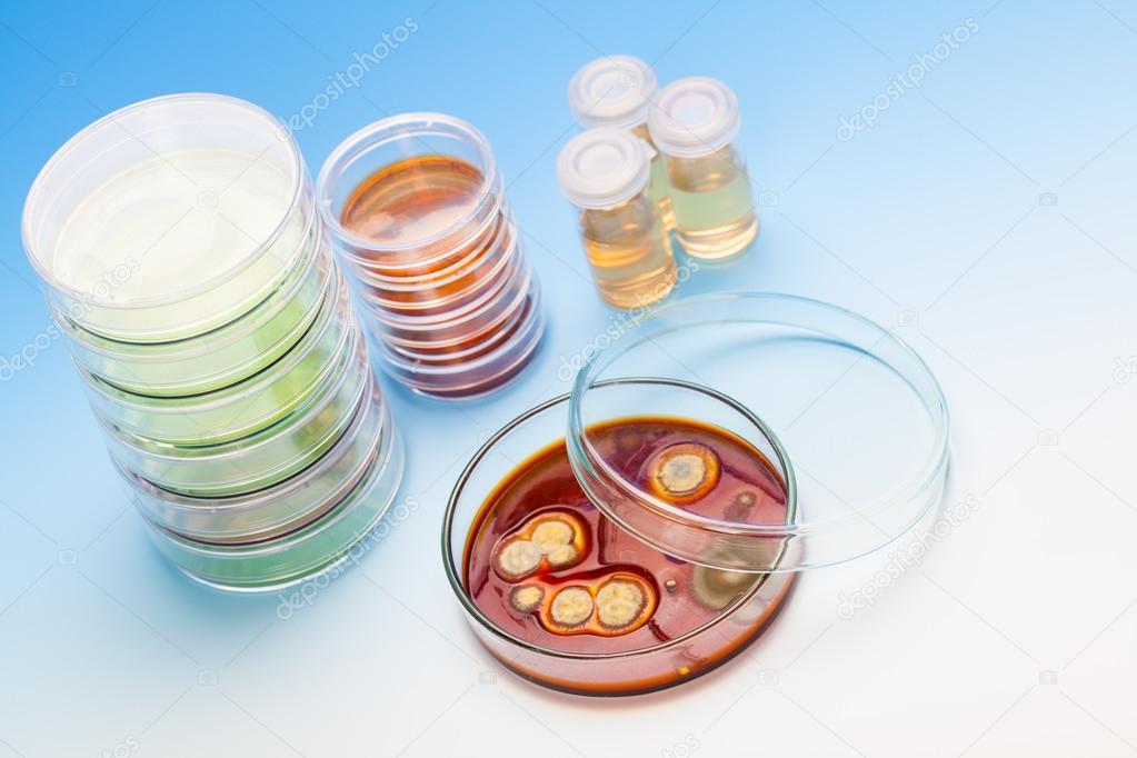 Petri dish with colonies of microorganisms
