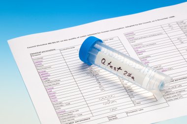 kimyasal ve mikrobiyolojik test tüpü içinde içme suyu