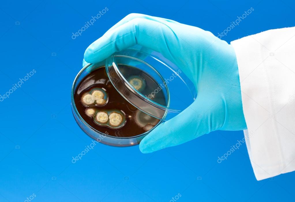 petri dish with bacterial colonies in the hand, on blue backgro