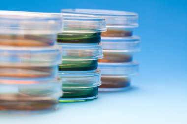 Petri yemeklerinde klinik laboratuvar