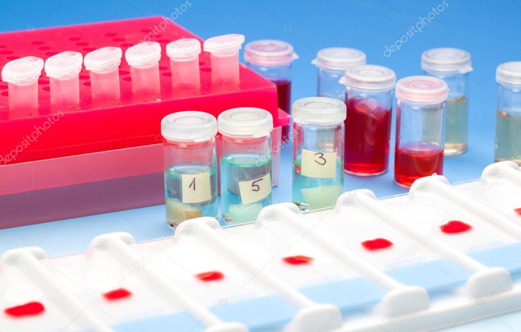 Array of blood samples for microscopy and biopsy tissue on blue