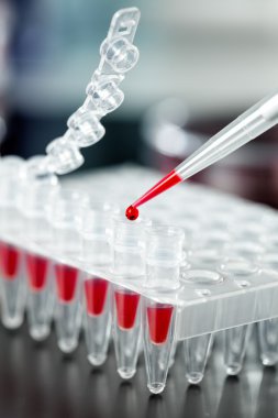 pcr örnek numaralı plastik tüpler yükleme