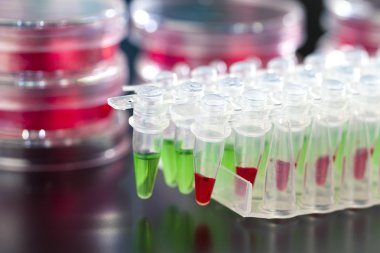 pcr ile dna amplifikasyon için ubes