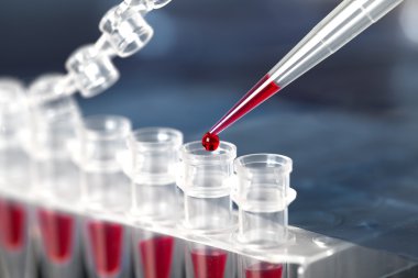 pcr ile dna amplifikasyon için ubes