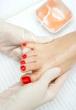 peeling tedavisi ayak