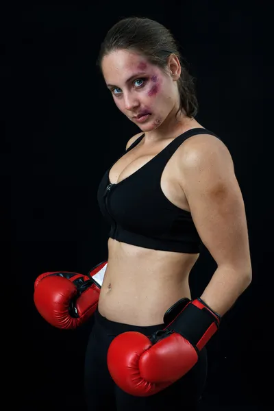 Boxeador mujer con moretones — Foto de Stock