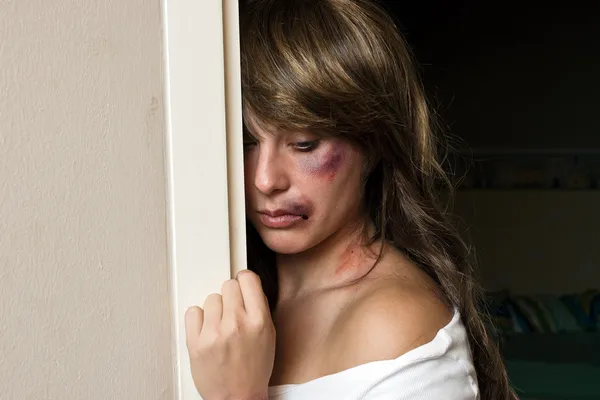 Mulher com hematomas se escondendo atrás da parede — Fotografia de Stock