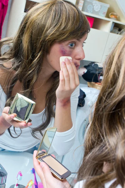 Mulher cobrindo hematomas com maquiagem — Fotografia de Stock