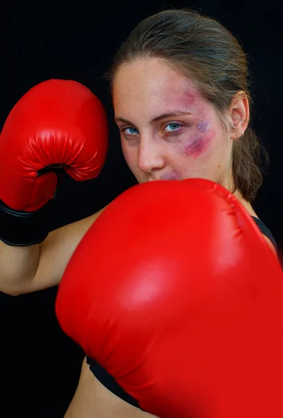 Woman boxer face with bruises and gloves — Stock Photo, Image