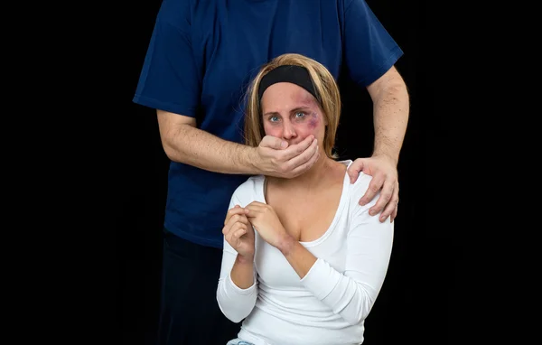 Женщина с синяками, жертва насилия — стоковое фото