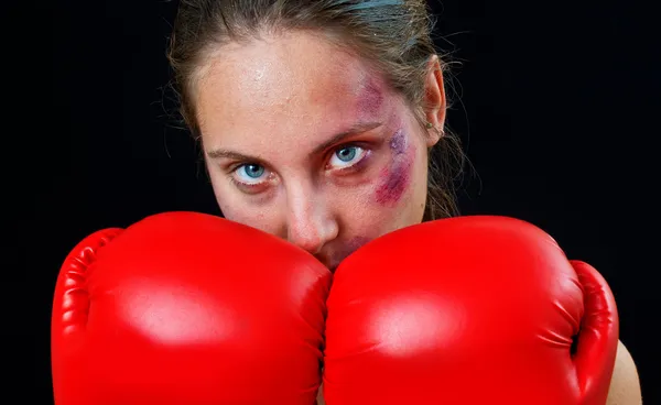 Mulher boxer rosto com hematomas e luvas Fotos De Bancos De Imagens