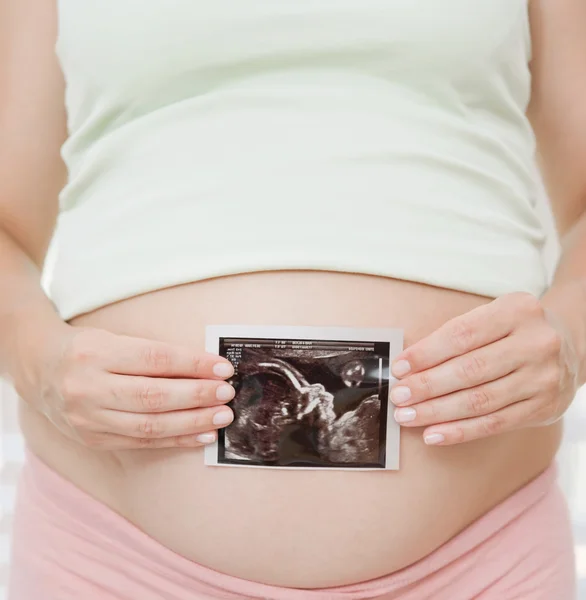 Mujer embarazada sosteniendo la fotografía de ecografía — Foto de Stock