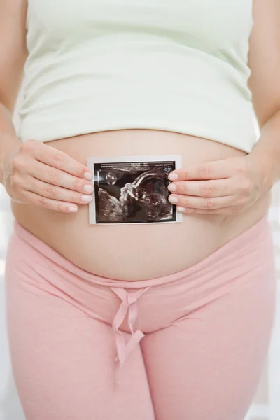 Donna incinta che tiene la fotografia ecografia — Foto Stock