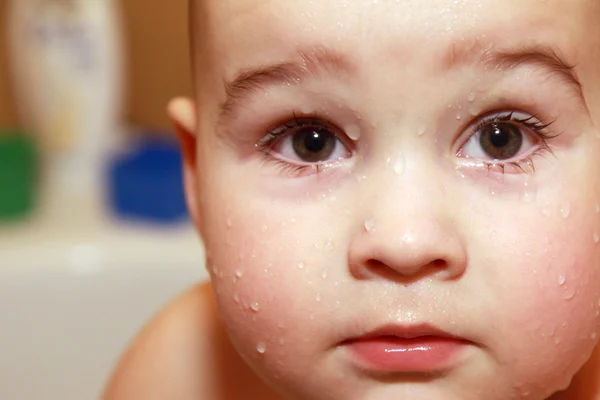 Face baby with drops — Stock Photo, Image