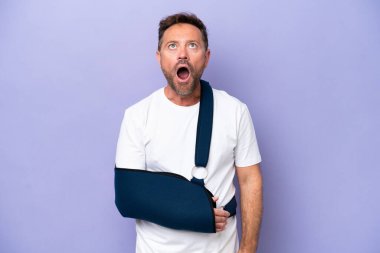 Orta yaşlı, kırık kollu, mor arkaplanlı askı takan beyaz bir adam yukarı bakıyor ve şaşırmış bir ifadeyle