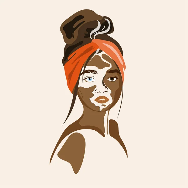 Stylish Vitiligo Woman Portrait Vector Illustration Modern Style Beauty Skin — Stockový vektor