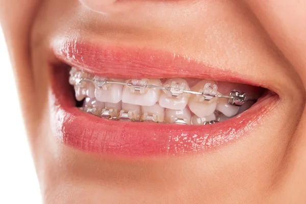 Ідеальні зуби — стокове фото