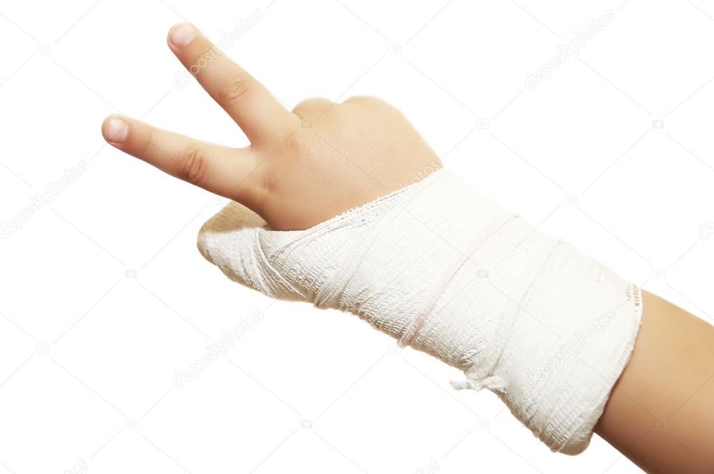 Broken hand