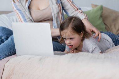 Blurred woman touching kid with down syndrome near laptop on bed  clipart