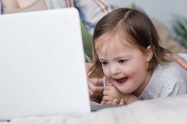 Down sendromlu heyecanlı çocuk annesinin yanındaki bulanık laptopa bakıyor. 