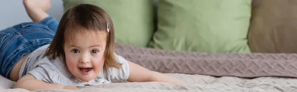 Sendromlu Çocuk Yatakta Kameraya Bakıyor — Stok fotoğraf