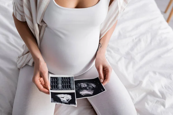 Частичный Взгляд Беременной Женщины Ультразвуковыми Снимками — стоковое фото