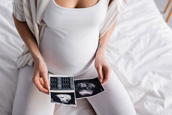 partial view of pregnant woman holding ultrasound pictures 