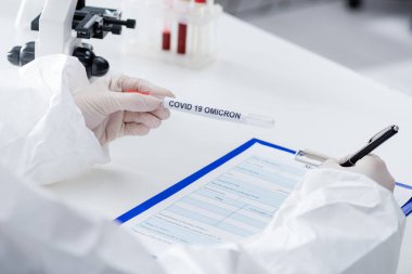 partial view of blurred doctor holding covid-19 omicron variant test tube while writing on clipboard in lab