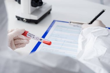 cropped view of blurred doctor with positive covid-19 omicron variant test writing on clipboard in lab