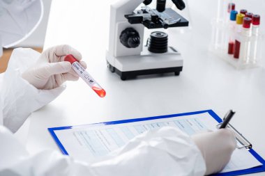 partial view of blurred scientist with positive covid-19 omicron test writing in medical card on clipboard near microscope