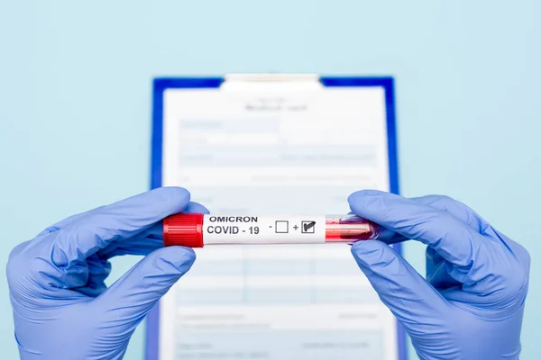 Cropped View Doctor Latex Gloves Holding Test Tube Covid Positive — Foto Stock