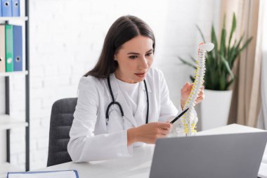 Klinikteki dizüstü bilgisayardaki görüntüler sırasında omurilik modelini gösteren doktor. 