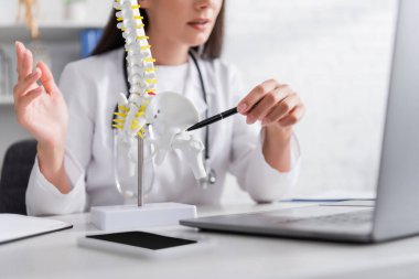 Hastanedeki bulanık dizüstü bilgisayarın yakınındaki omurilik modeline bakan doktor görüşü. 