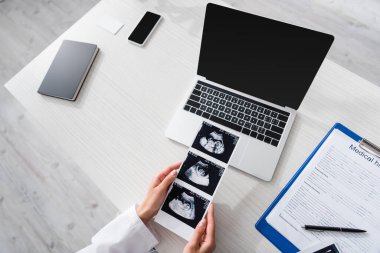 Top view of doctor holding ultrasound scan of baby near medical history and devices in clinic 