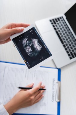 Top view of doctor holding ultrasound scan of baby near blurred medical history and laptop 
