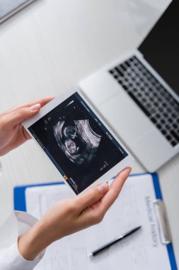 Top view of doctor holding ultrasound scan of baby near blurred laptop and clipboard in clinic 