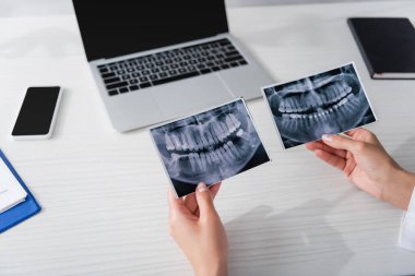 Klinikteki bulanık cihazların yakınında diş taraması tutan doktorların görüntüsü. 