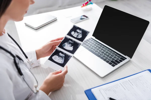 Vista Cortada Médico Segurando Ultra Som Varredura Bebê Perto Área — Fotografia de Stock