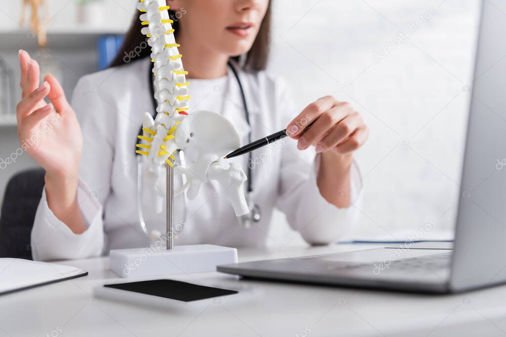 Cropped view of doctor pointing at spinal model near blurred laptop in hospital 