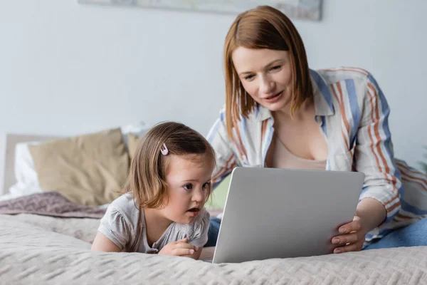 Baby with down syndrome looking at laptop near blurred mother in bedroom — Stock Photo