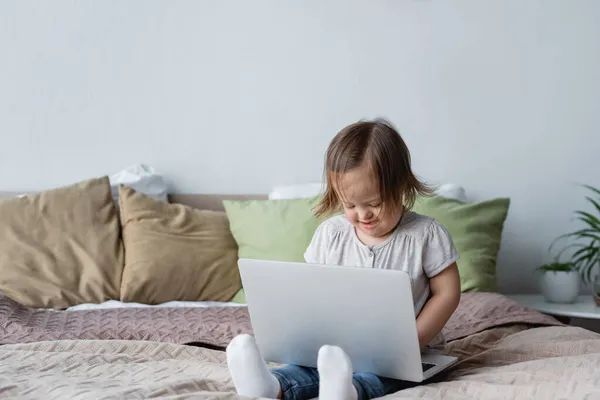 Lächelndes Mädchen mit Down-Syndrom mit Laptop zu Hause im Bett — Stockfoto