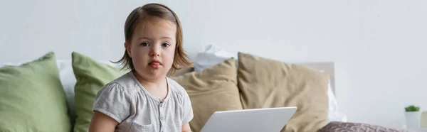 Niño con síndrome de Down mirando a la cámara cerca de la computadora portátil en el dormitorio, pancarta - foto de stock